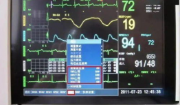 心电监护仪的操作视频,轻松掌握生命体征监测技巧